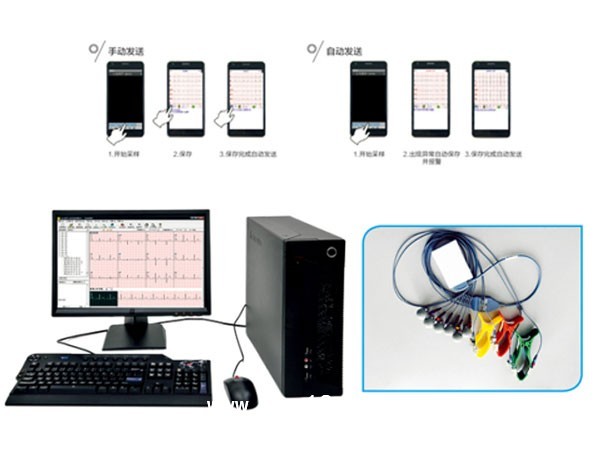 远程心脏监护系统