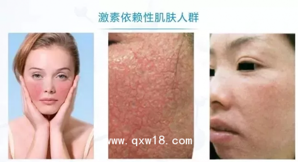 图片6