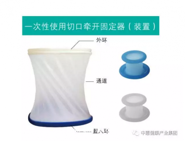 一次性使用固定器